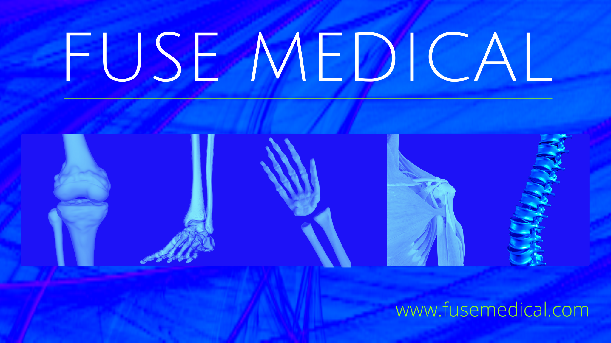 investors-fuse-medical